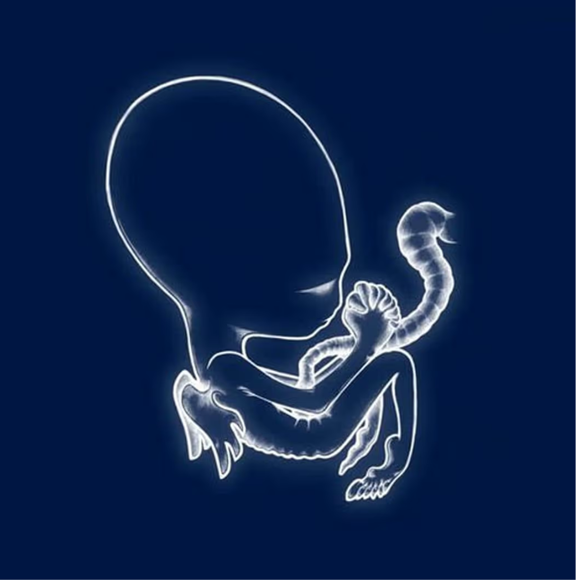 Sigur Rós - Ágætis Byrjun (Vinyl 2LP)